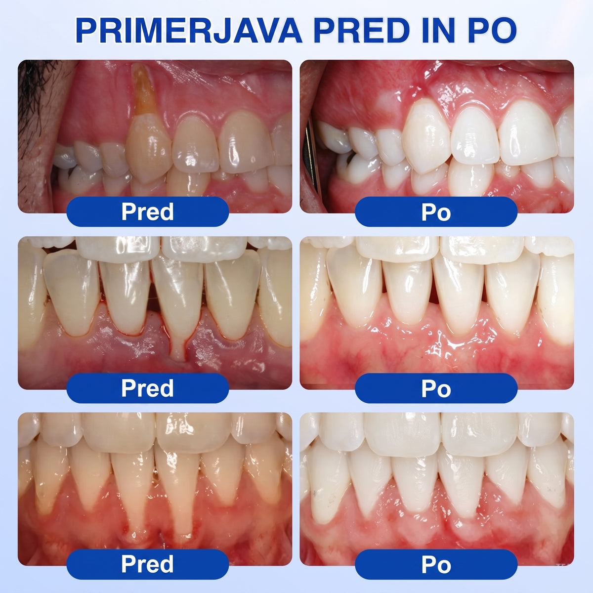 斯洛文尼亚牙齿🇸🇮🏅🦷🛡️Dr.Era® GumRevive Gel za obnovo obzobnih tkiv💎（副本）