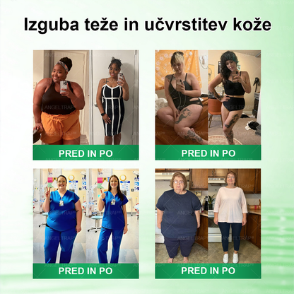 ✨ANGELTRAP® Moringa × Berberin × AMPK 10-v-1 Metabolična podpora, obliž z nanotehnologijo mikroiglic 🇸🇮 (Dovolj je enkrat na dan, vidni rezultati v 7 dneh) ✅ Za debelost, ohlapno kožo, sladkorno bolezen, spalno apnejo, težave s sklepi in številne druge