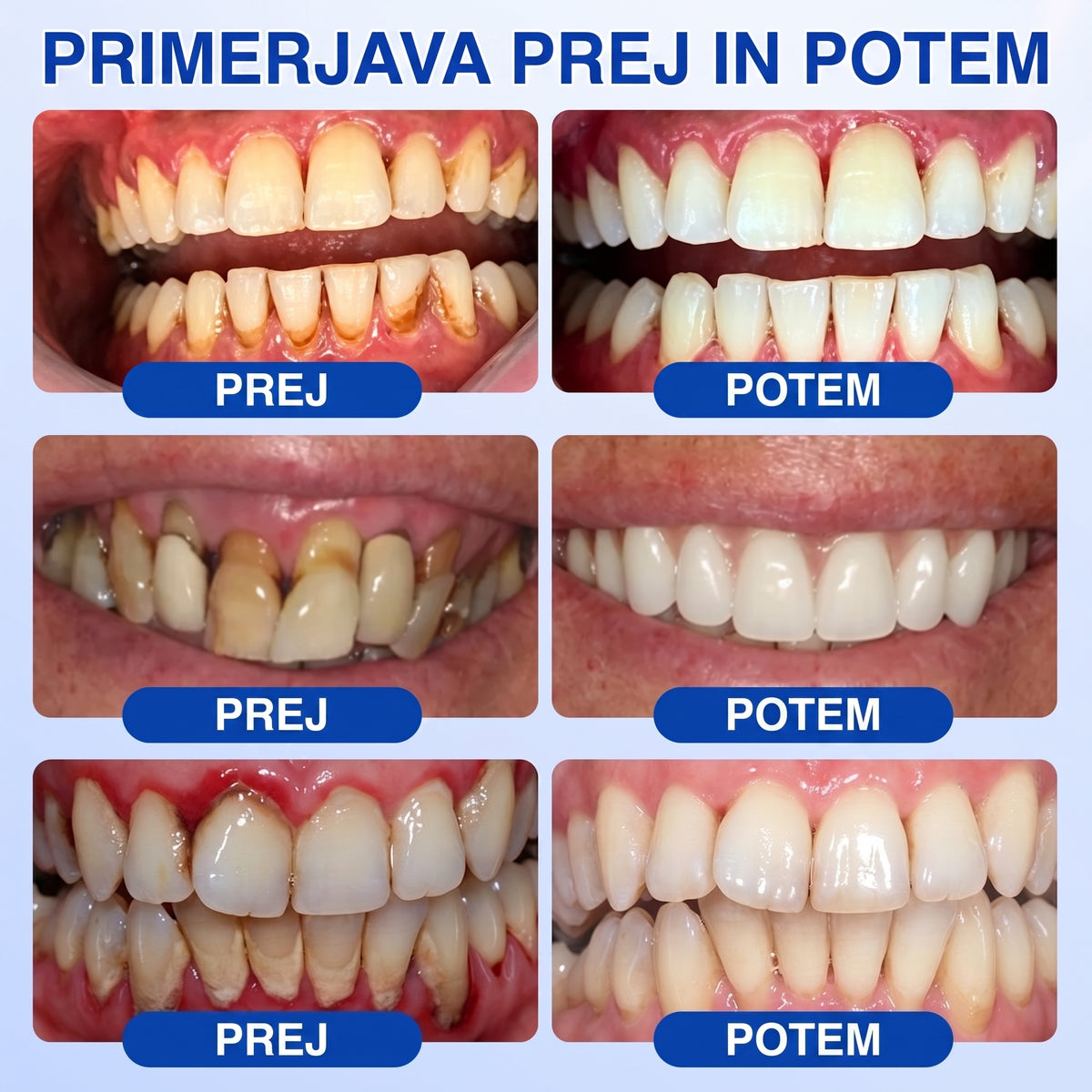斯洛文尼亚牙齿🇸🇮🏅🦷🛡️Dr.Era® GumRevive Gel za obnovo obzobnih tkiv💎（副本）