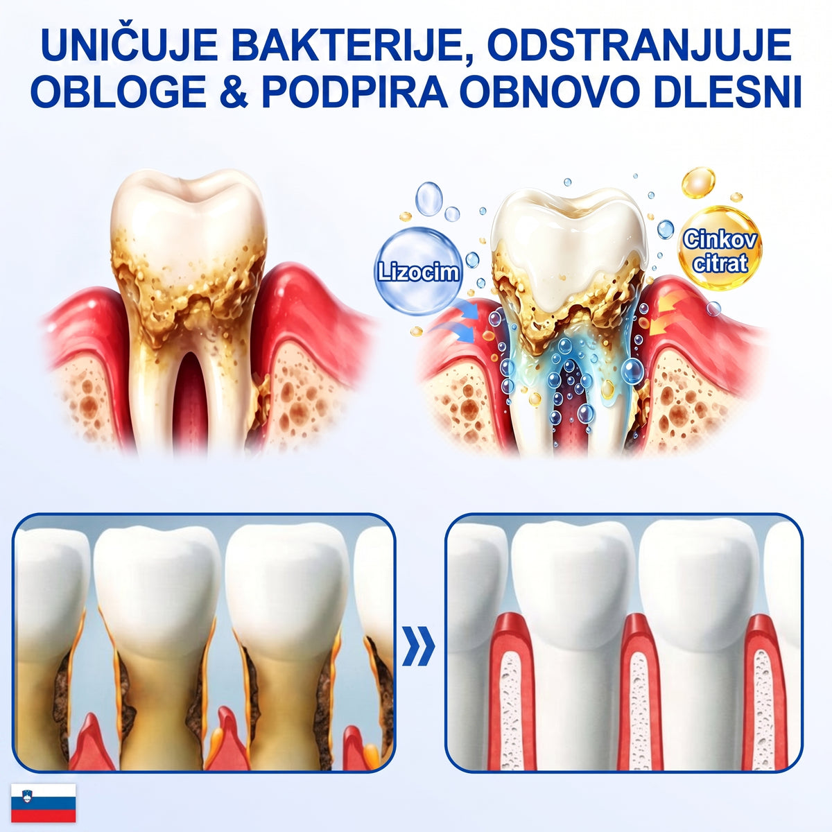 斯洛文尼亚牙齿🇸🇮🏅🦷🛡️Dr.Era® GumRevive Gel za obnovo obzobnih tkiv💎（副本）