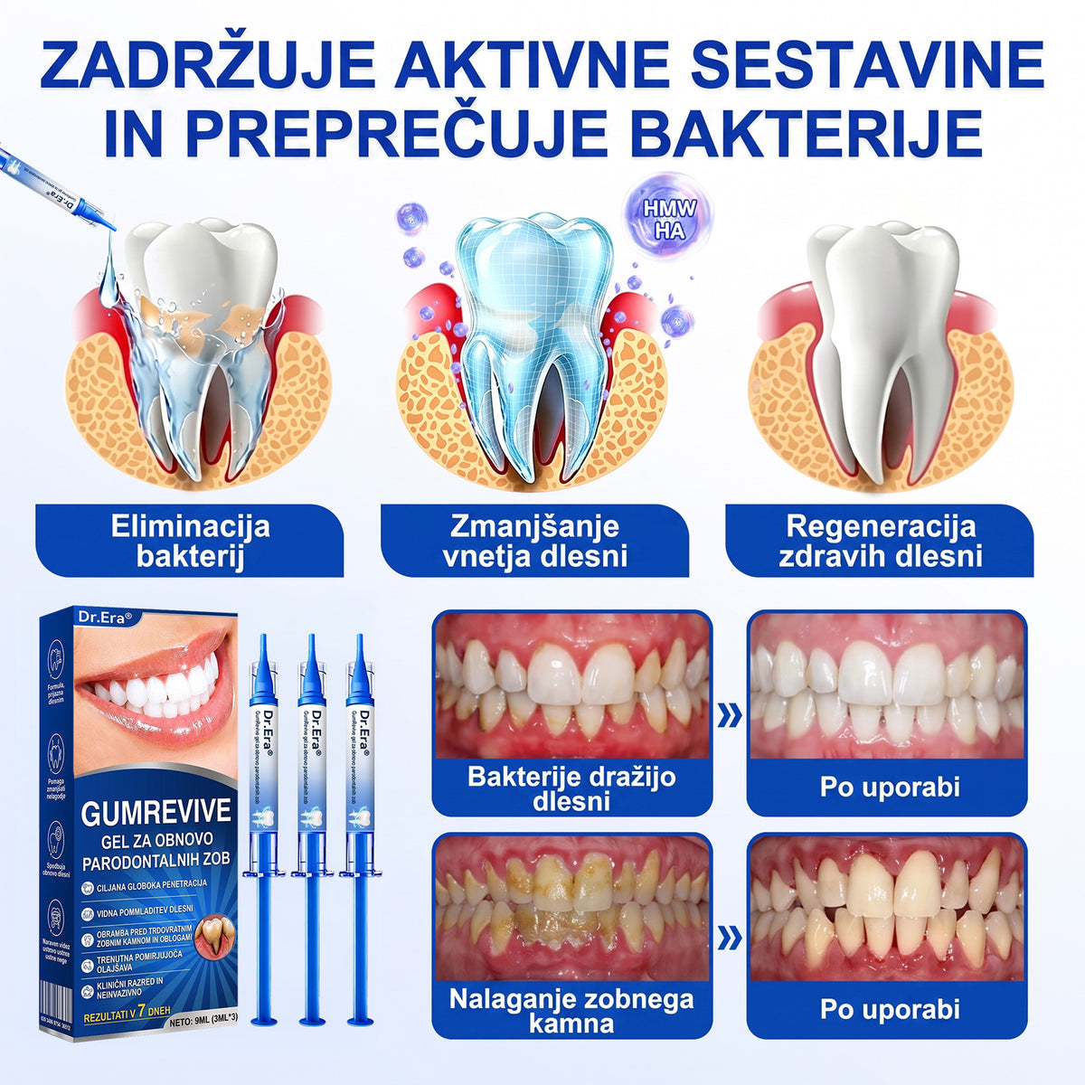 斯洛文尼亚牙齿🇸🇮🏅🦷🛡️Dr.Era® GumRevive Gel za obnovo obzobnih tkiv💎（副本）